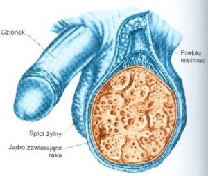 Reumatyzm: objawy i leczenie choroby.