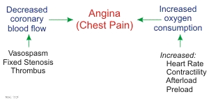 Care este diferența dintre angina pectorală și tahicardie
