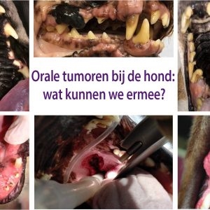 Diagnostiek van het acuut myocardinfarct