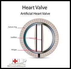 Todo sobre la válvula mitral: anatomía, fisiología y enfermedad