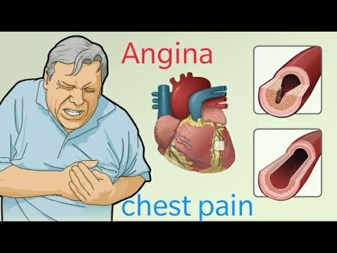 Descrierea, semnele, clasificarea și tratamentul anginei instabile