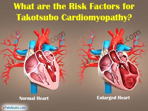 Symptomen, typen en behandeling van cardiomyopathie bij volwassenen