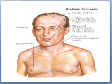 Totul despre distonia neurocirculatoare: definiție, tipuri și simptome