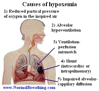Príčiny, symptómy, liečba hypoxie myokardu