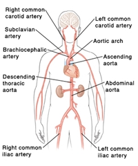 Aortaaneurysm: beskrivning, diagnos och behandling