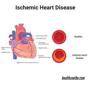 Συμπτώματα και πρόληψη αιφνίδιου θανάτου και καρδιακής ανεπάρκειας