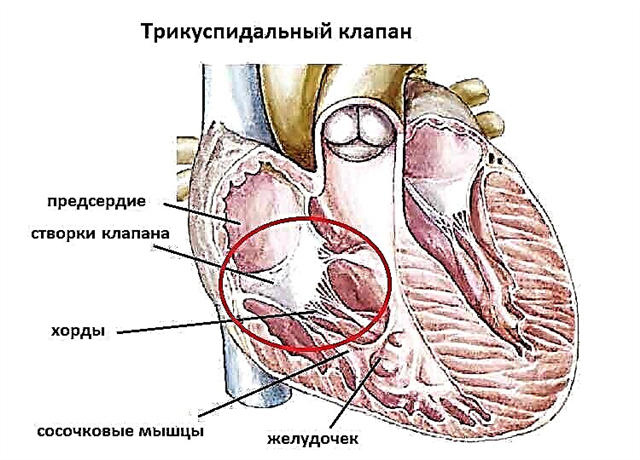 All about the tricuspid valve: structure, mechanism of operation, main tasks