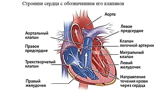 Viss par sirds defektiem: patoloģiju raksturojums un pacienta prognoze