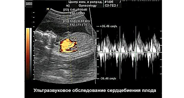 Ist es möglich, das Geschlecht eines Kindes anhand seines Herzschlags im Mutterleib zu bestimmen?