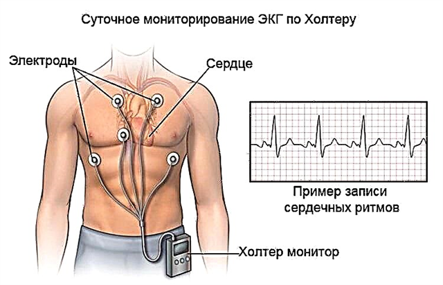 Holter EKG daglig overvåking (HM): hva er det, hvordan gjøre og dechiffrere