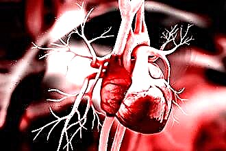 Ce să faci dacă ventriculul stâng al inimii este mărit?