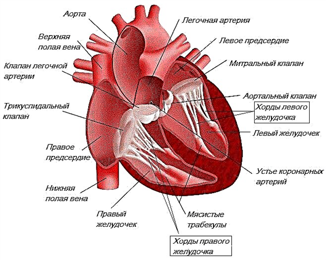 Zusätzliche Trabekel in der linken Herzkammer