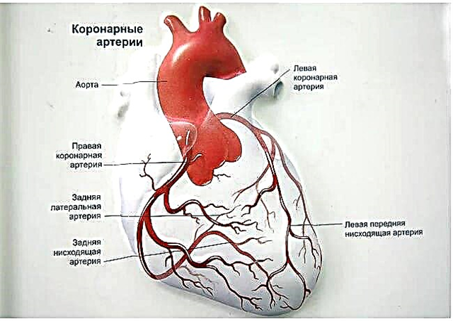 Coronary heart failure