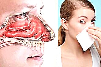 Membrana mucosa de la nariz