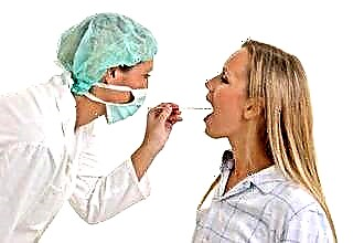 All about herpes sore throat in adults and children