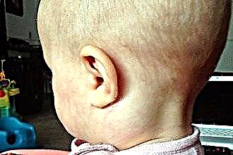 A criança tem um linfonodo inflamado atrás da orelha
