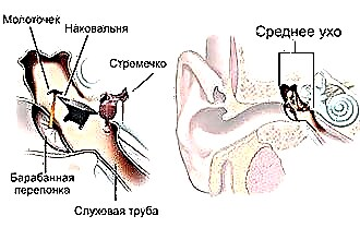 मध्य कान के रोग