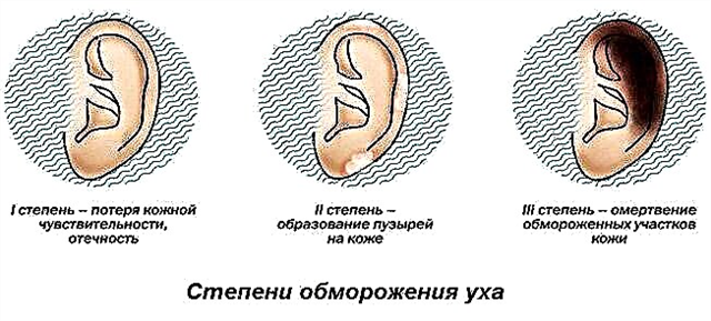 Wat te doen bij bevriezing van de oren?