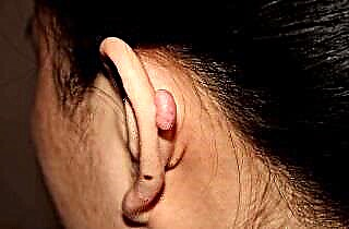 Behind the ear is a ball - what is it?