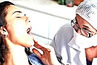 成人の扁桃腺と喉の口内炎