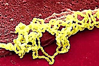 Οι πιο συνηθισμένοι τύποι στρεπτοκοκκικών βακτηρίων