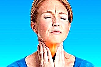 Treating sore throat at home