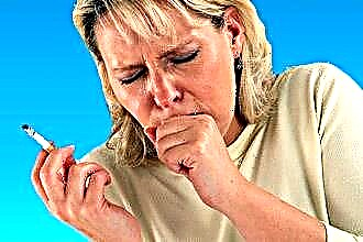 Sore throat causes