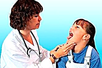 小児の急性咽頭炎の症状と治療