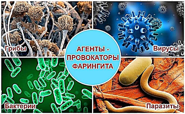 Clasificación de tipos de faringitis.