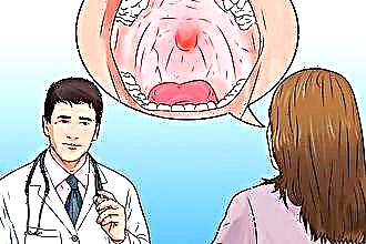 Kaip suteikti skubią pagalbą sergant laringotracheitu