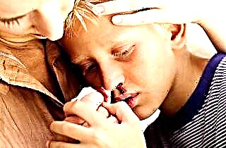 Nasenbluten bei einem Kind bei einer Temperatur