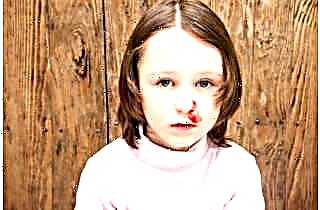 Why does a child often have nosebleeds?