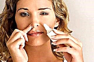 Nosies polipų gydymas liaudies gynimo priemonėmis
