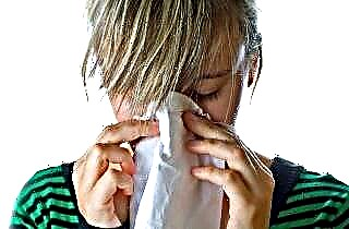 Merkmale der Symptome der Nasenpolypen