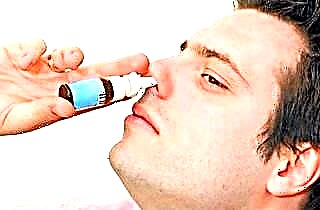 Uzroci i liječenje oticanja nosa s curinjem iz nosa