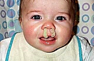 Svullnad i ett barns näsa: orsaker och metoder för eliminering
