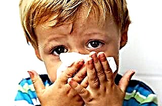 Signos de nariz rota en un niño y tratamiento posterior.
