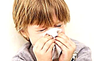 أعراض التهاب الجيوب الأنفية عند الأطفال وخيارات العلاج