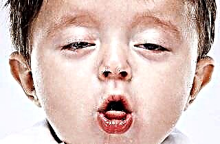 Severe obsessive cough in a child
