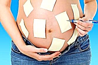 Ubat untuk rinitis semasa kehamilan pada trimester yang berbeza