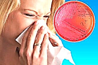 Leczenie bakteryjnego nieżytu nosa