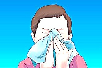 Persistent nasal congestion in children