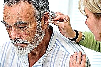 Orsaker till hörselnedsättning och dövhet