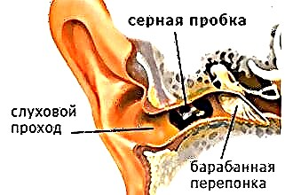 Korvan paine