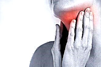 Long-term sore throat without fever
