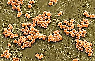 Staphylococcus-uitstrijkje analyse