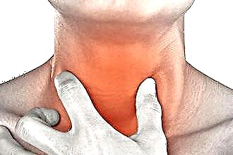 Causes of discomfort in the throat