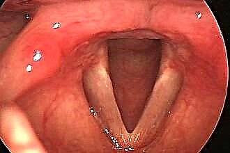 Sindrom vnetega grla
