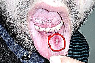 Plaque on tonsils without temperature