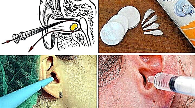 How to rinse your ear at home?